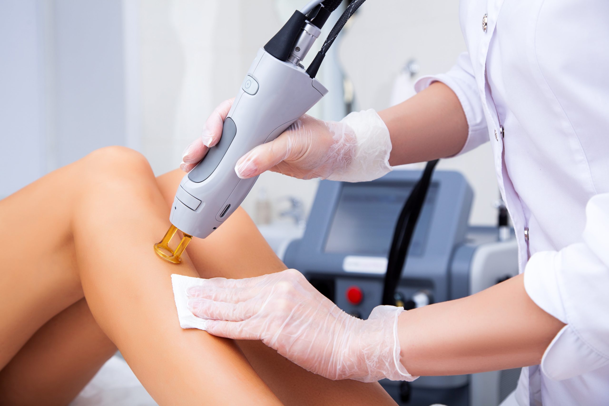 What Are The Benefits of Laser Hair Removal Treatment