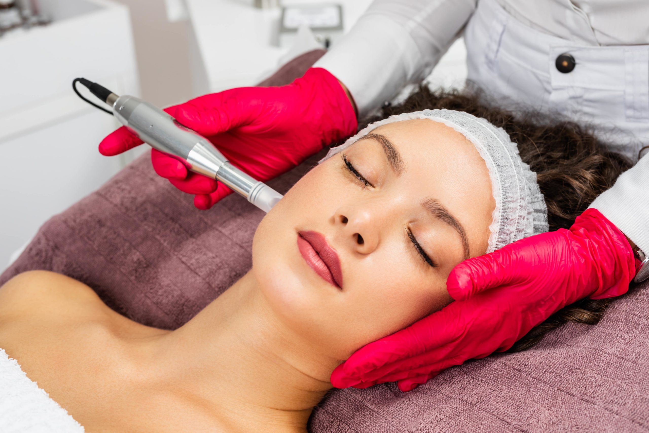 Microneedling by Rediscover Aesthetics in Mandeville LA