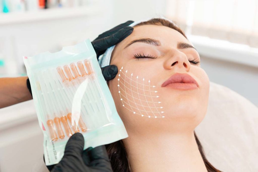 PDO Thread Lift by Rediscover Aesthetics in Mandeville LA