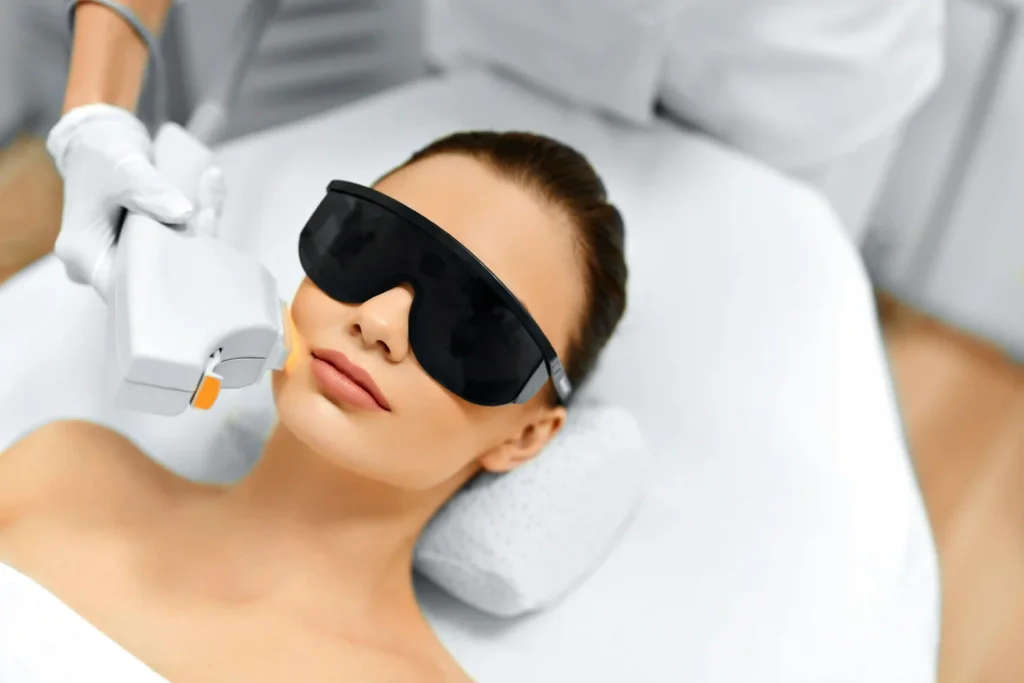 IPL Treatments by Rediscover Aesthetics in Mandeville LA