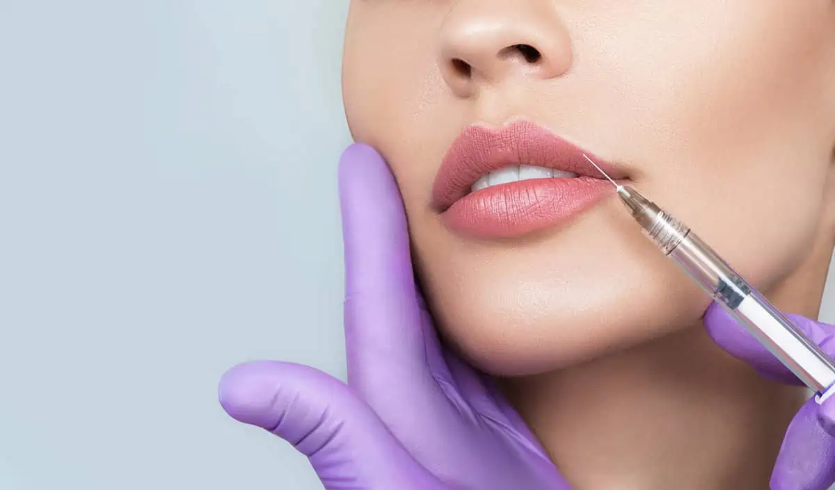 Lip Fillers by Rediscover Aesthetics in Mandeville, LA