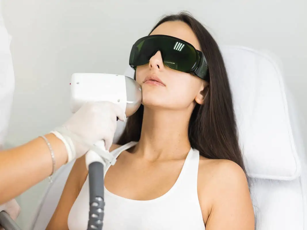 laser hair removal by Rediscover Aesthetics in mandeville la