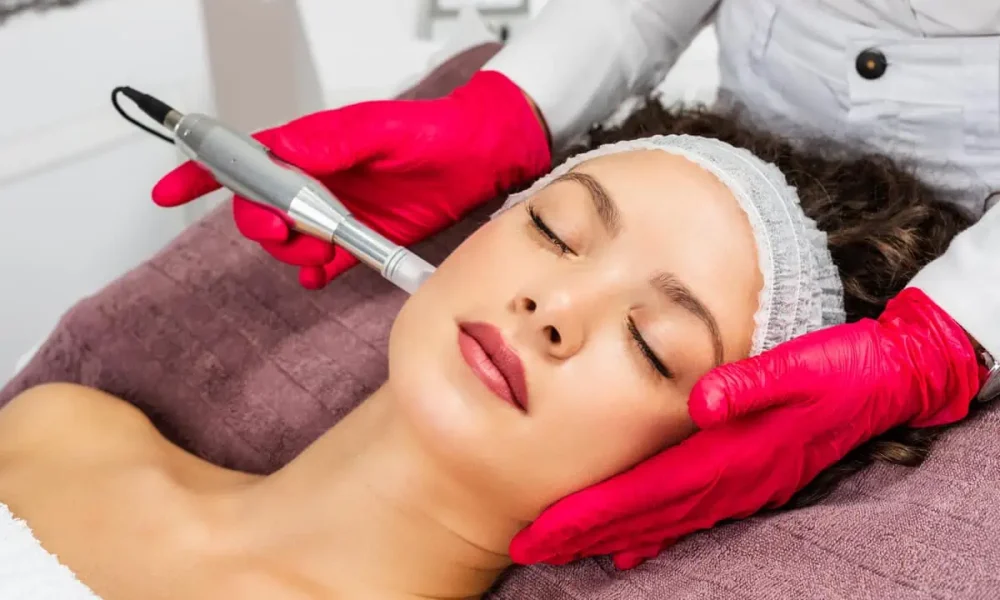 Microneedling by Rediscover Aesthetics in Mandeville, LA