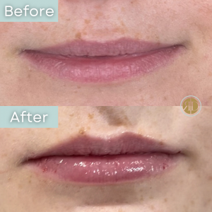 what is the difference between skin structure and texture lips
