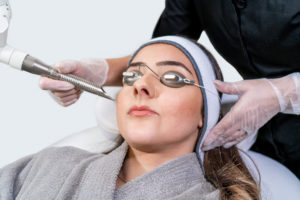 What Are The Benefits Of An IPL Photofacial?