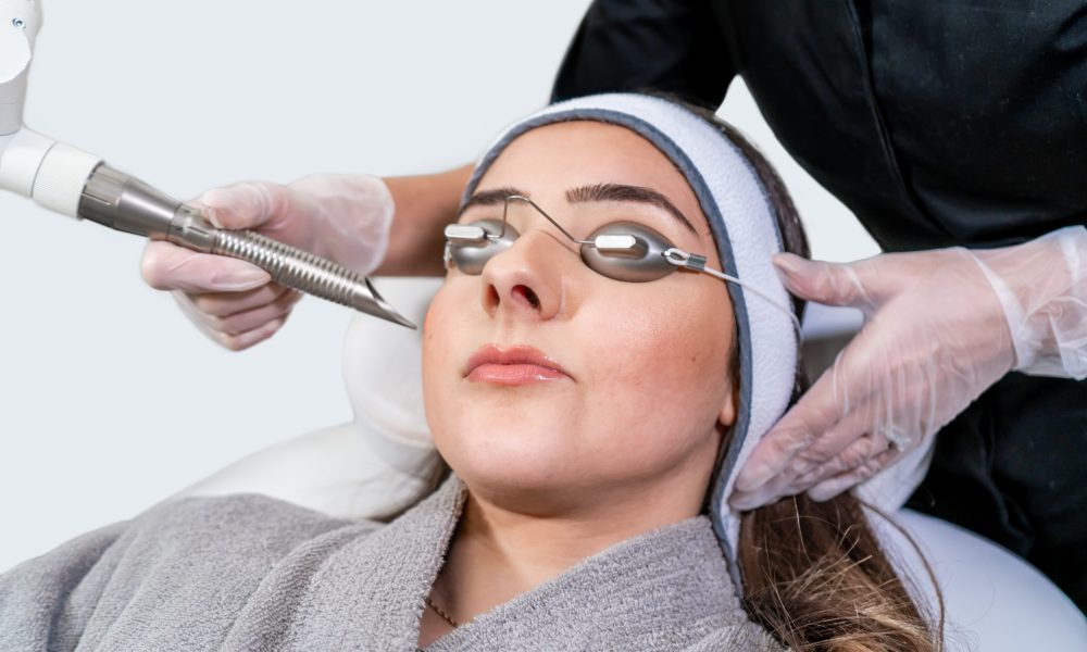 What Are The Benefits Of An IPL Photofacial?